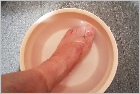 足の臭いを消す方法は「重曹＋クエン酸の足湯」